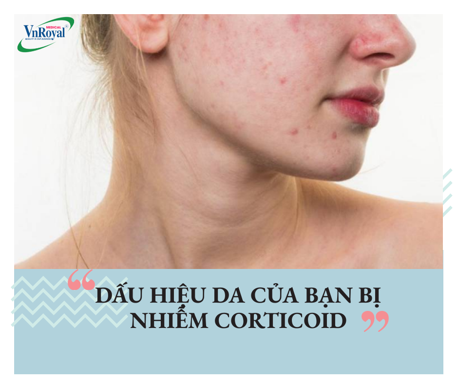 Signs your skin is infected with corticosteroids