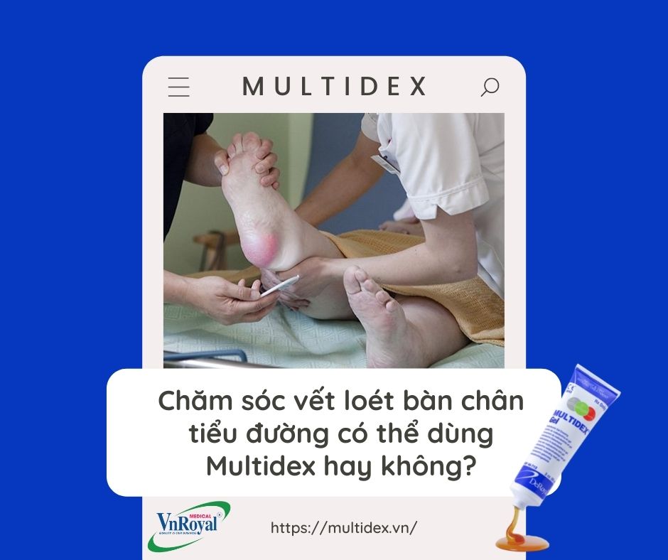 Chăm sóc vết loét bàn chân tiểu đường có thể dùng Multidex hay không?